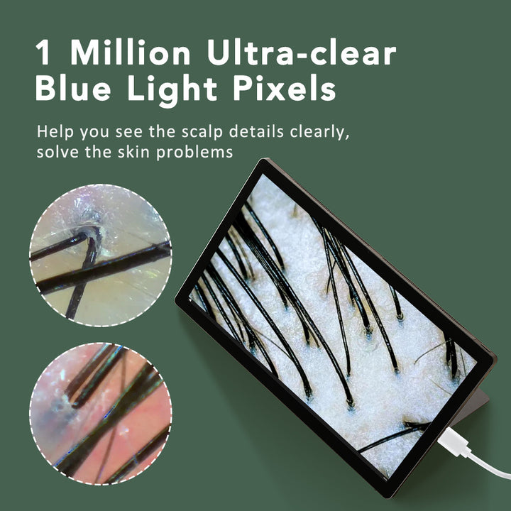 HD Scalp Detector WiFi Visual Skin Analysis Instrument